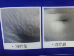 点击看大图 -成都军建医院·疤痕诊疗中心