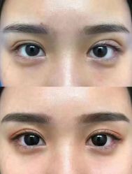 -素美医疗美容·西南眼鼻整形·修复基地