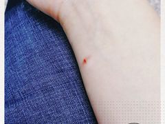 -广州中医药大学第三附属医院(骨伤科分院)