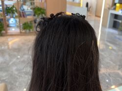 -碧莲盛·不剃发植发