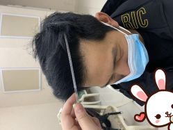 -大麦微针植发丨全国连锁