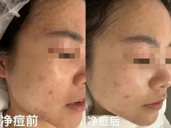-美肌工坊皮肤管理
