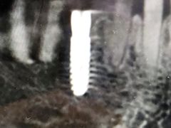 -精德口腔·种植修复·儿牙中心(财富中心店)