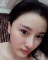 -大麦微针植发全国连锁