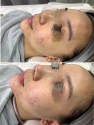 点击看大图 体验前-SKIN79皮肤管理中心