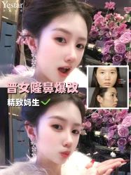 -Yestar艺星整形美容医院