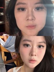 -上海伊莱美医疗美容医院