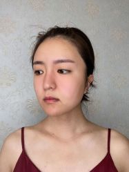 -联合丽格·张菡丽格医疗美容