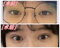 -素美医疗美容·西南眼鼻整形·修复基地
