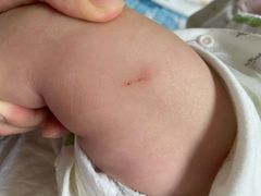 -北京市朝阳区奥运村社区卫生服务中心