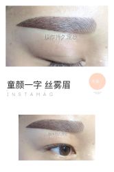 点击看大图 -光SPA科技美肤