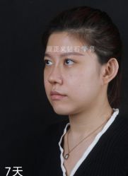 -北京米扬丽格医疗美容·联合丽格鼻整形中心
