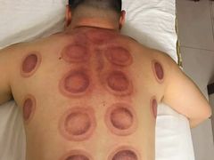 -安琪盲人按摩调理草本熏蒸馆(风和日丽店)