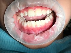 -天使口腔门诊部(上海店)