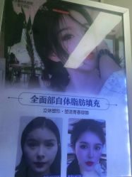-成都西区医院整形美容