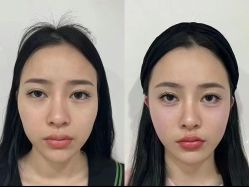 -Yestar艺星医疗美容医院