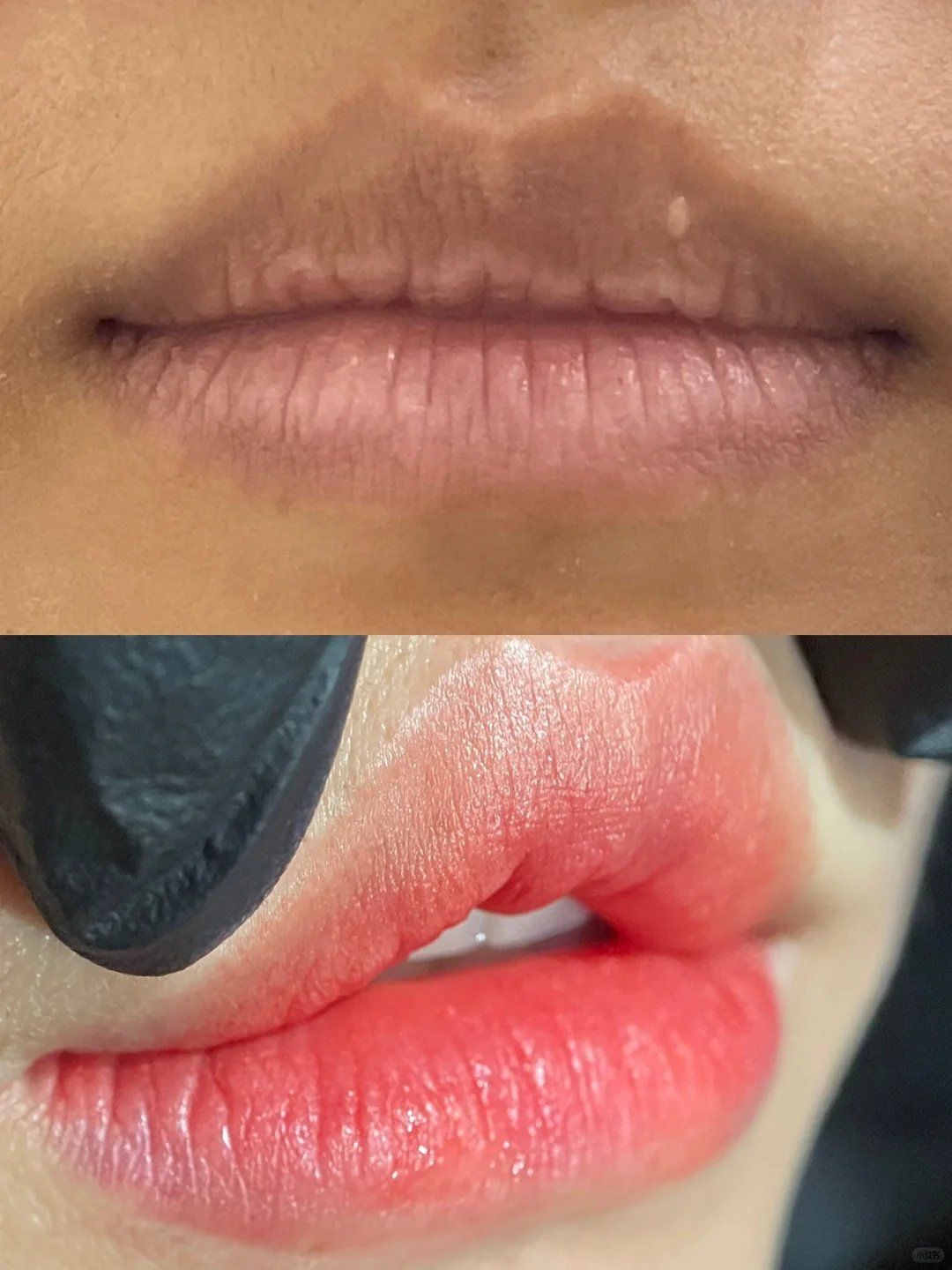 深唇救星 我也可太懂深唇的姐妹了