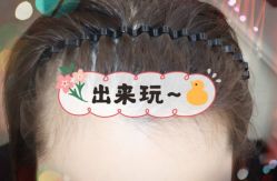 -大麦微针植发全国连锁