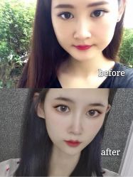 -天津伊美尔医疗整形美容专科医院
