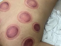 -传古推拿·古法按摩(凤阳东路店)