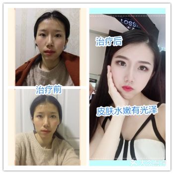 让你告别瑕疵皮肤轻松拥有水嫩肌肤的黑科技!!