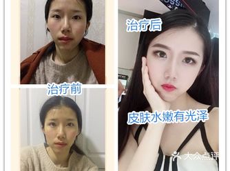 让你告别瑕疵皮肤轻松拥有水嫩肌肤的黑科技!!