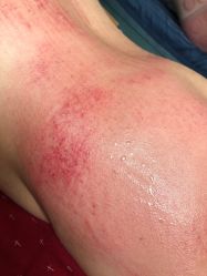 -苗塑堂减肥艾灸