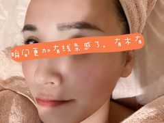 -FACE·日本小颜美容整骨(福田店)