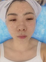 体验前-亿美医疗美容·半岛大超炮官方授权店