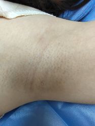 -广州美莱医疗美容医院