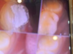 -土豆口腔(凤凰北总店)