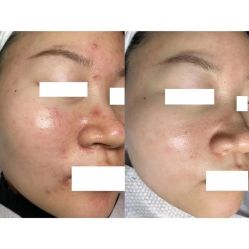 -美肤盾祛痘·问题肌头疗管理中心