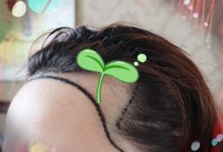 -大麦微针植发全国连锁