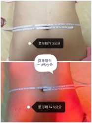 -良咔瘦身·减脂塑形