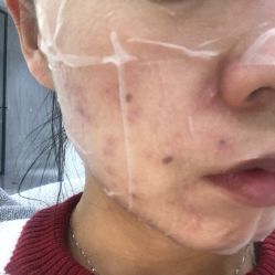 -媛音医美