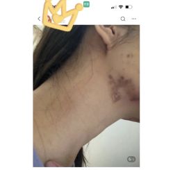 -美瑞莎创美医疗美容
