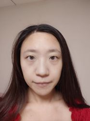 体验后-JUVA郑州欧华医疗美容医院
