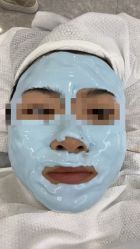 -悟空祛痘·诺奖技术专业店