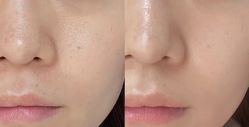 -SKINIST丽铂医疗美容