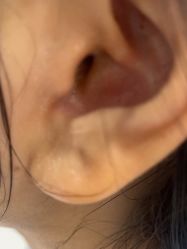 -美瑞莎创美医疗美容