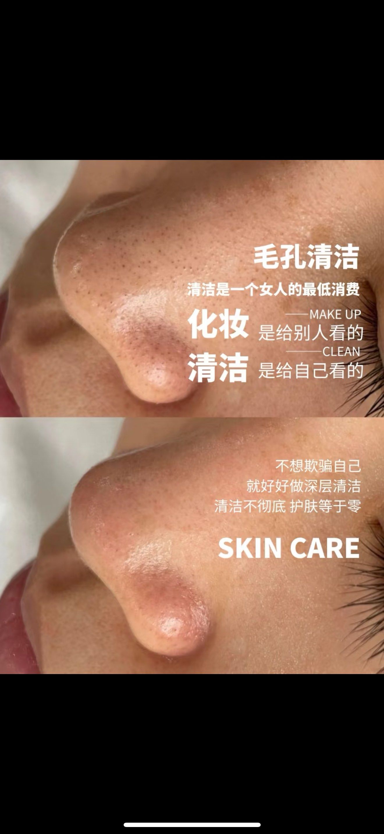毛孔净化管理