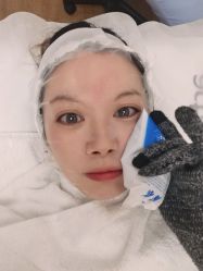 体验后-澳玛·星光医疗美容