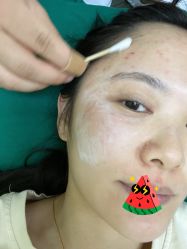 体验后-北京八大处第二医疗美容医院
