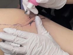 -明星刺青·洗纹身