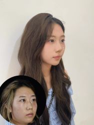 -Yestar重庆艺星医疗美容医院