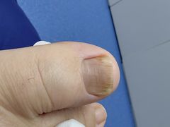 -Andrew指甲专科灰指甲·甲沟炎矫正·3D步态矫形鞋垫定制(上海法华镇路旗舰店)
