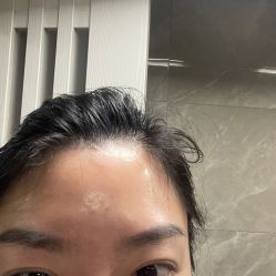 体验后-agge蛋白医美