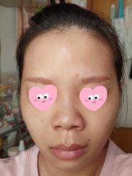 体验前-广州美莱医疗美容医院