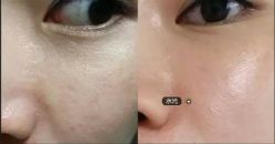 -SKINIST丽铂医疗美容