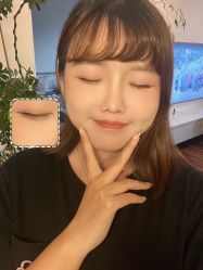 体验后-华臣医疗美容